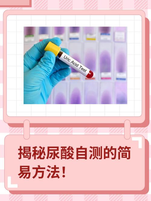 尿酸自测最简单方法:6070岁尿酸最新标准