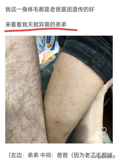 什么是体毛:什么体毛越多越好看